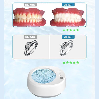 Máy vệ sinh khay niềng răng, khay duy trì & hàm giả, công nghệ Sóng Siêu Âm, model A9