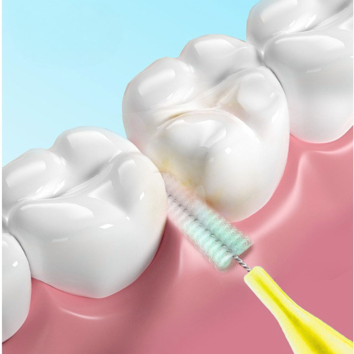 Bàn chải kẽ răng Aslan chữ I - 0.4 mm - vệ sinh khe kẽ răng