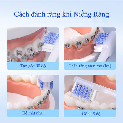 Bàn chải đánh răng cho người niềng răng YGate - chữ U