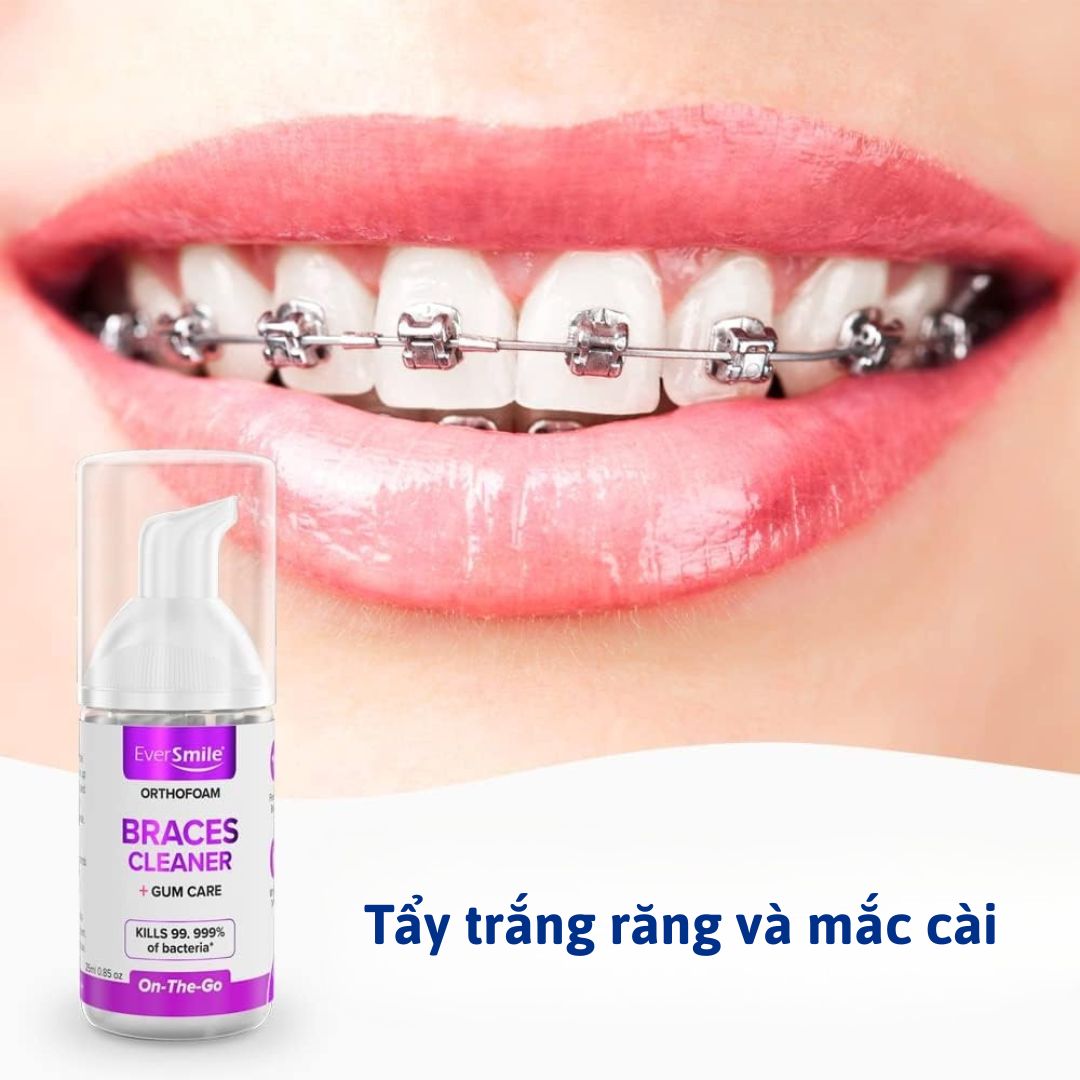 Chai bọt vệ sinh răng miệng khi niềng răng mắc cài OrthoFoam