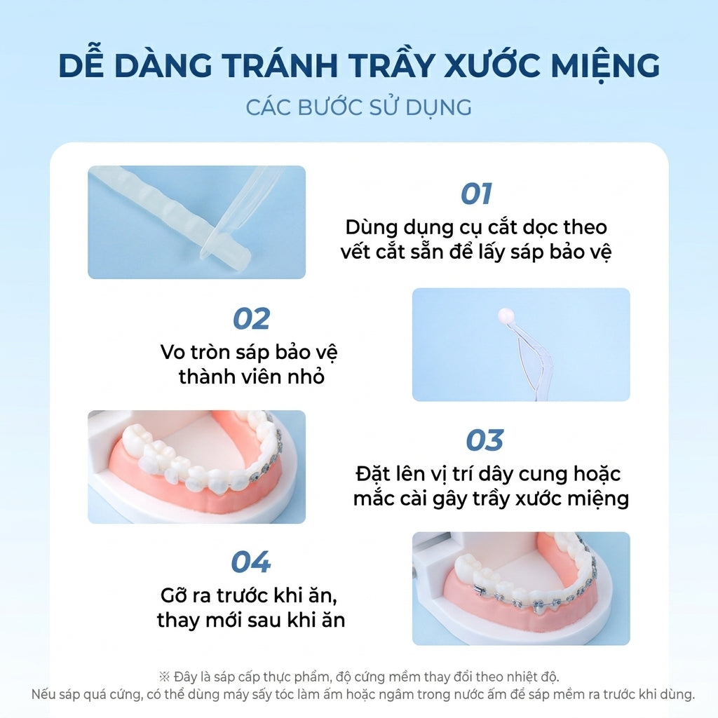Sáp Nha Khoa YiGate Cho Niềng Răng Mắc Cài – Sáp Niềng Răng Giảm Đau, Chống Loét Miệng (Hộp 35 Miếng)