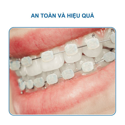 Sáp Nha Khoa YiGate Cho Niềng Răng Mắc Cài – Sáp Niềng Răng Giảm Đau, Chống Loét Miệng (Hộp 35 Miếng)