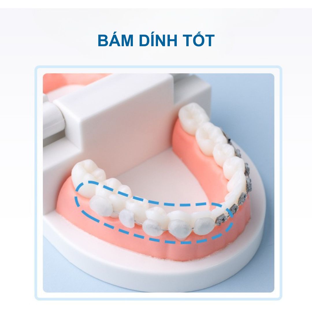 Sáp Nha Khoa YiGate Cho Niềng Răng Mắc Cài – Sáp Niềng Răng Giảm Đau, Chống Loét Miệng (Hộp 35 Miếng)