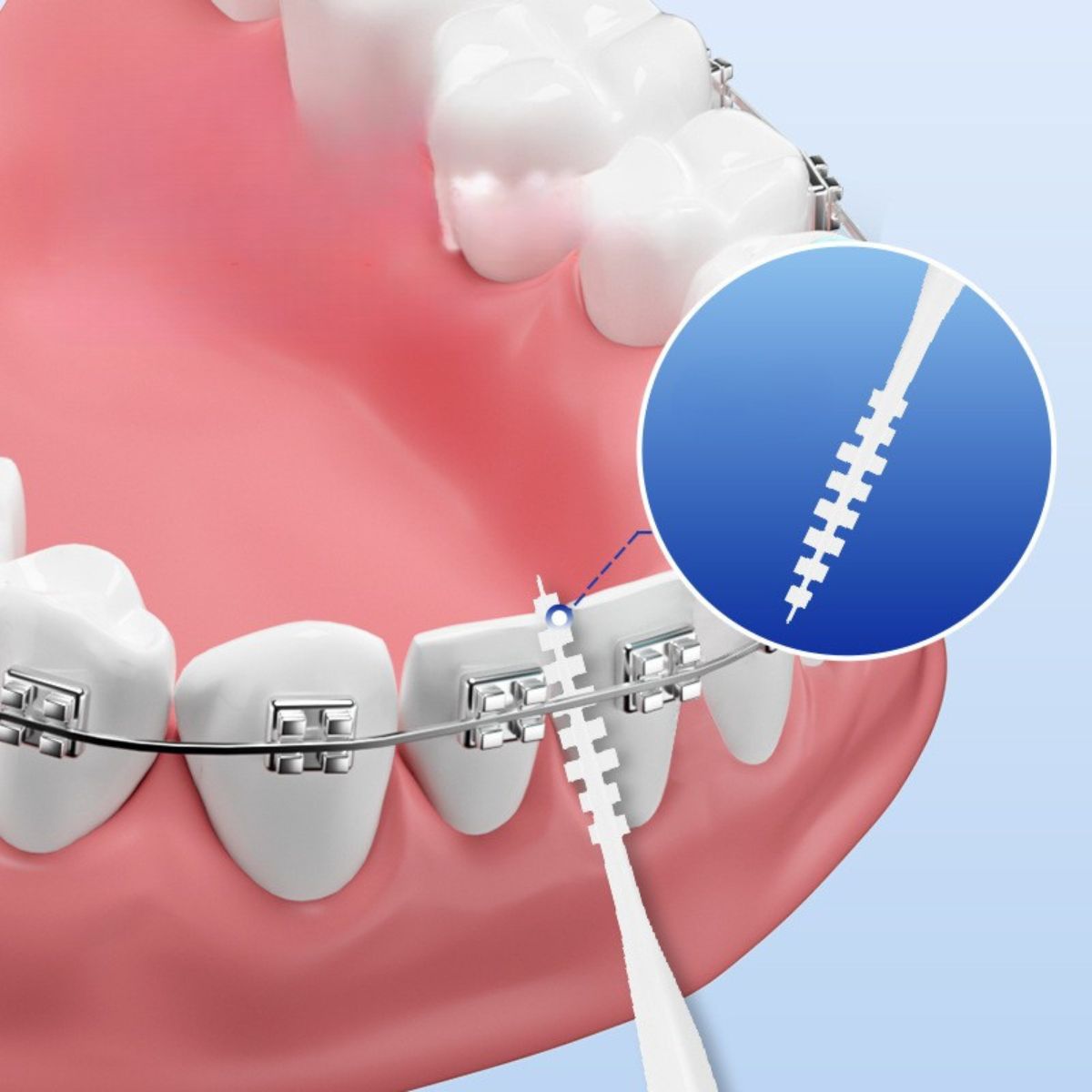 Tăm Chỉ Nha Khoa Cho Người Niềng Răng Mắc Cài (Thiết Kế 2 Đầu Tích Hợp Bàn Chải Kẽ)